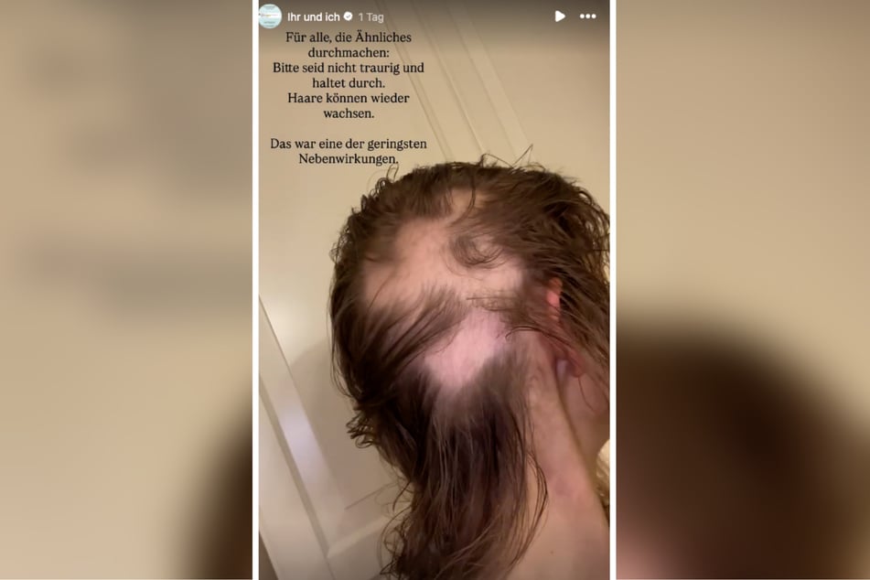 Die 30-Jährige kämpft noch immer mit den Nebenwirkungen der Krebs-Therapie.