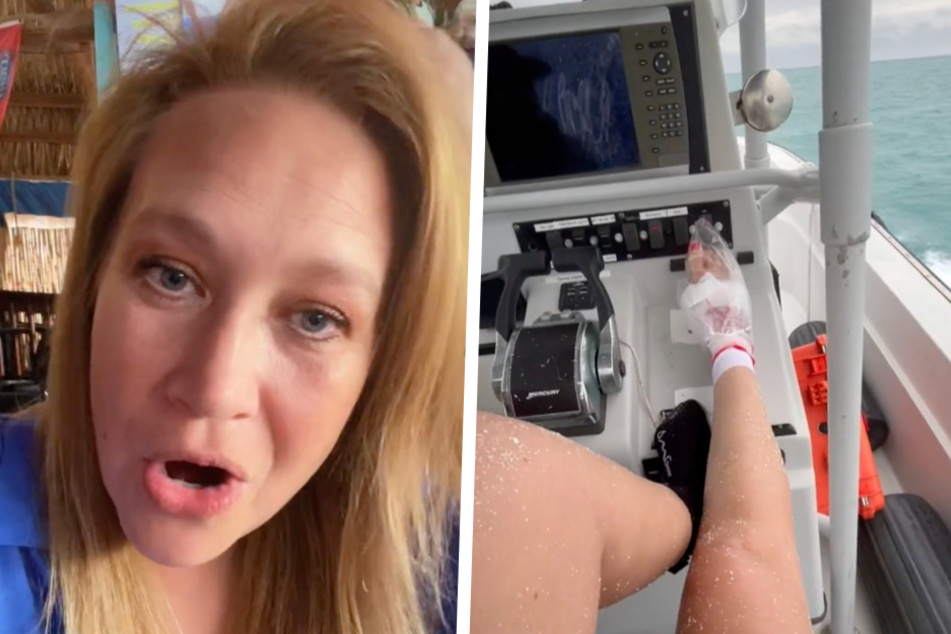 Shark attack victim goes TikTok viral after "smacking" animal in the face