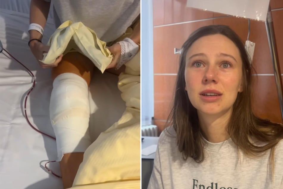 Influencerin Ann-Kathrin Bendixen (24), aka "Affe auf Bike", ist nach ihrem schweren Rollerunfall in Vietnam operiert worden.