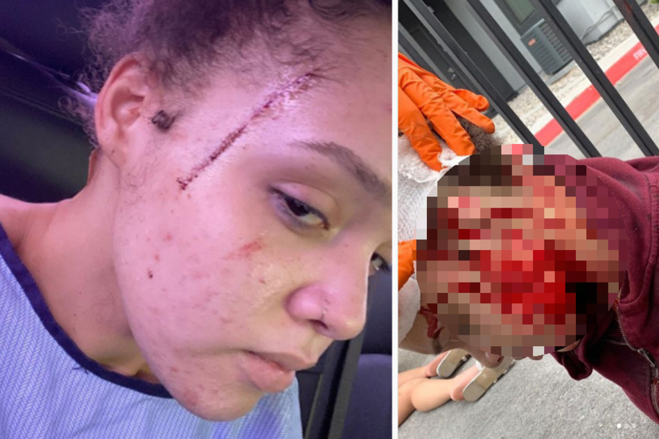 Yasmine Jackson (25) postete schockierende Bilder von der Tat.