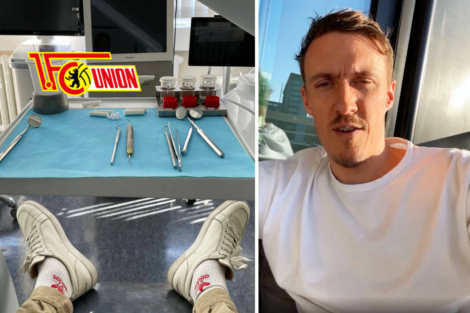 Union Berlin: Derby-Einsatz von Max Kruse nach Zahnarztbesuch in Gefahr?