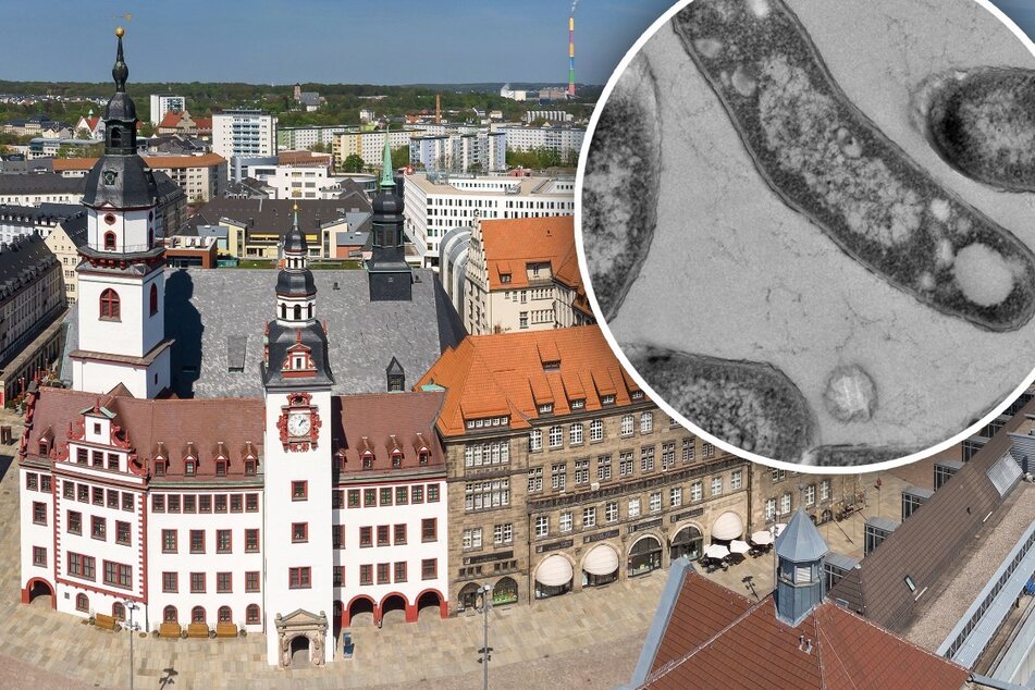 Chemnitz: Tuberkulose in Chemnitz: Schon der sechste Fall in diesem Jahr