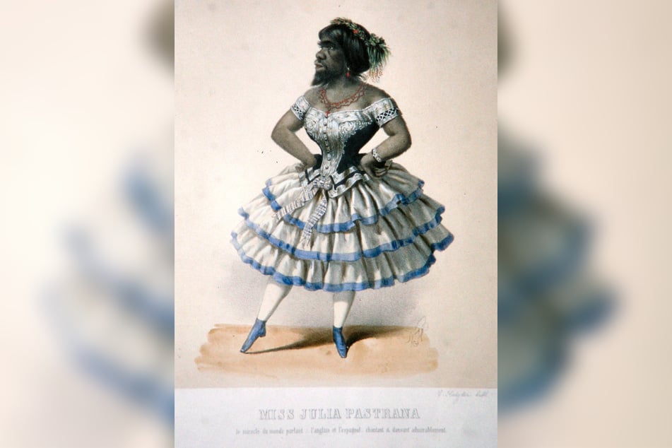 Die Leiche der "Affendame" Julia Pastrana (1834-1860) wurde in Dresden ausgestellt.