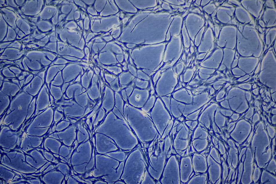 Proben kultivierter Fischzellen sind auf einem Monitor eines Mikroskops von "Bluu Seafood" zu sehen.