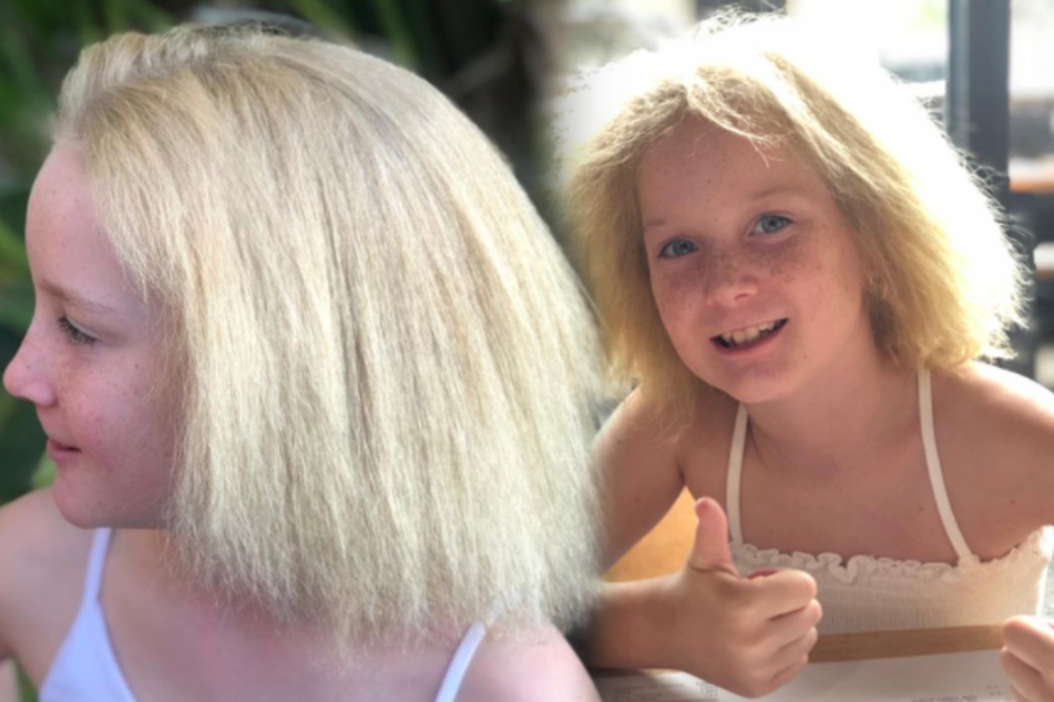 Uncombable hair syndrome is a thing, but this little girl is learning to  love her unruly mane | TAG24