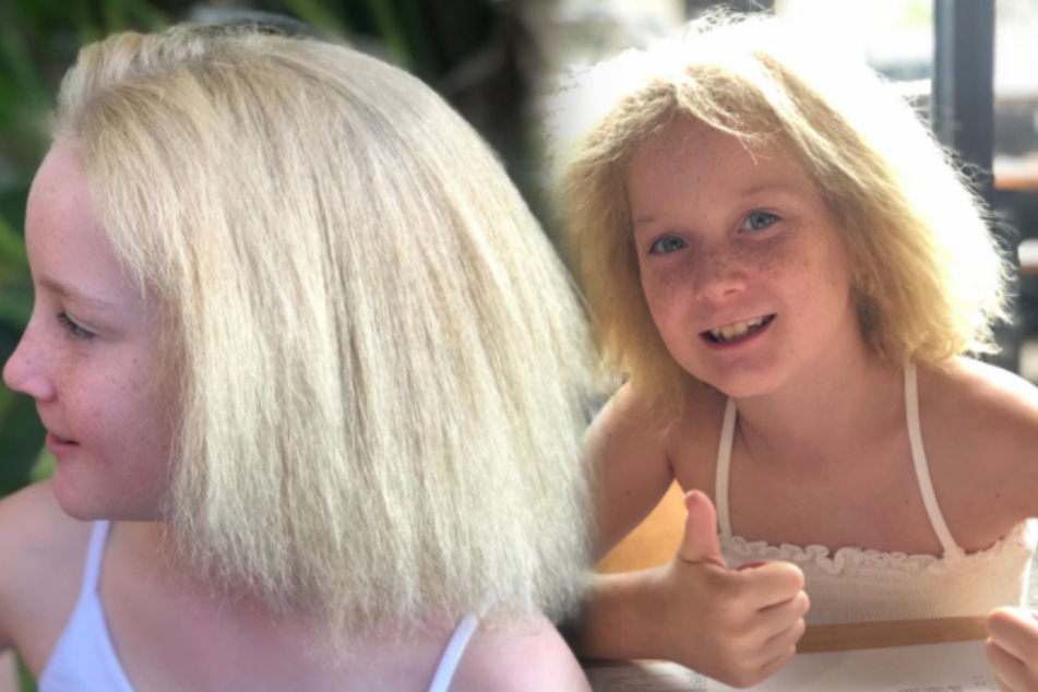 Uncombable hair syndrome is a thing, but this little girl is learning to love her unruly mane