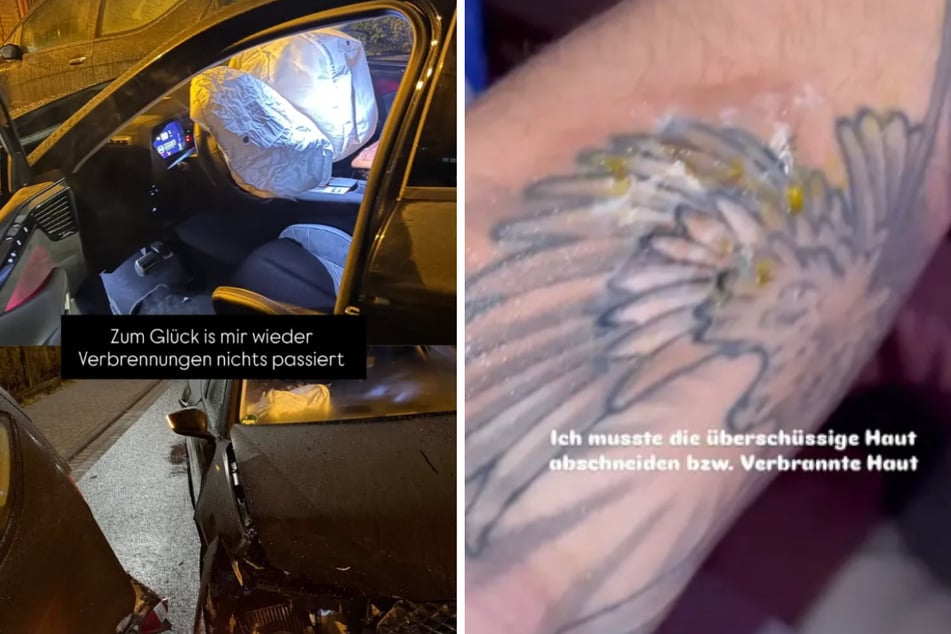 Auf Instagram teilte der junge Schauspieler einige schockierende Fotos zu seinem Crash.