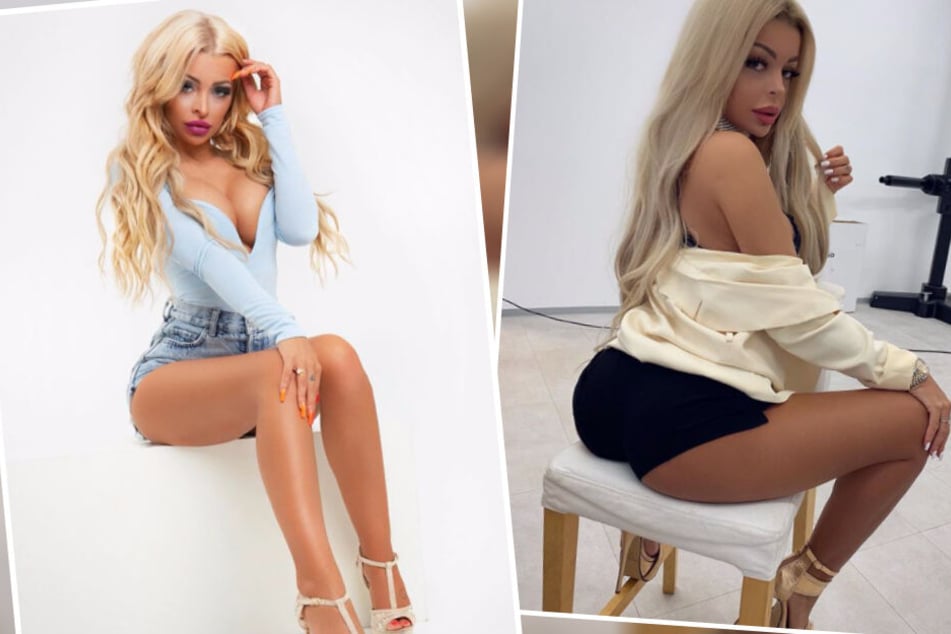 Katja Krasavice hat sich wieder unters Messer gelegt