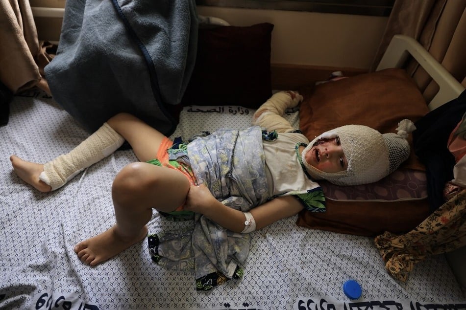 Five year-old Abla Zaanoun receives treatment for her burns sustained in an Israeli strike, at the Nasser hospital in Khan Younis in the southern Gaza Strip.