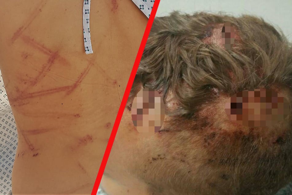 Blutige Attacke auf 20-Jährigen in Sachsen: Zeigen diese Bilder das Opfer?