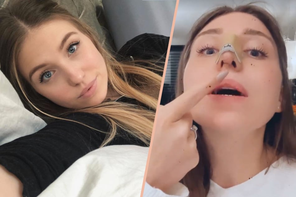 Nach ihrer Brust- und Nasen-Operation hatte Influencerin Bianca Claßen (28) bislang keine größeren Beschwerden. Jetzt macht sich die 28-Jährige Sorgen um ihre Nase.
