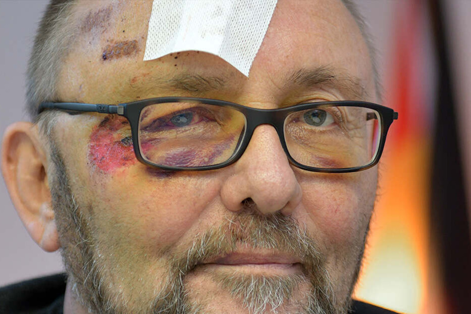 Frank Magnitz, Landesvorsitzender der AfD Bremen, wurde am 07.01.2019 von unbekannten Tätern angegriffen.