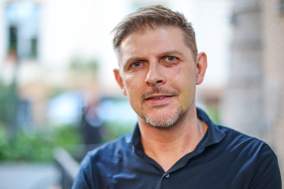 SPD-Politiker Matthias Ecke (43) wurde im Mai 2024 beim Plakatieren in Dresden abgepasst und brutal attackiert.