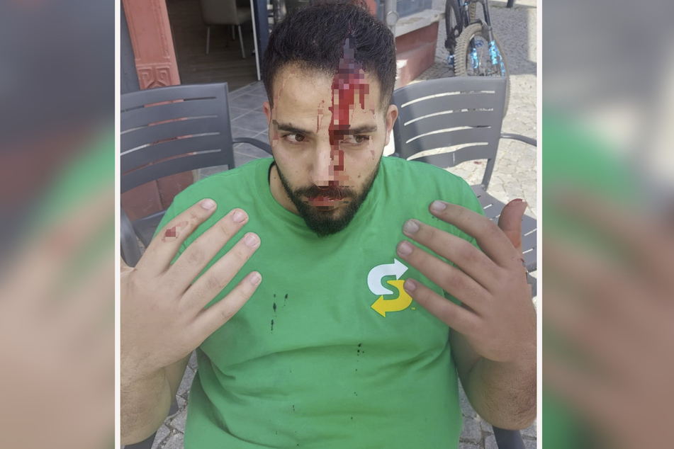 Ahmad Raed (24) hat es schwer erwischt. Am Pfingstmontag musste der Maschinenbau-Student medizinisch versorgt werden.