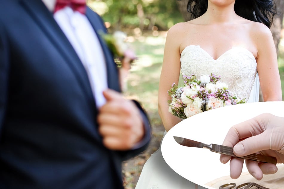 Bei der Hochzeit sitzen gelassen: Enttäuschte Medizinerin schneidet Verlobtem Penis ab