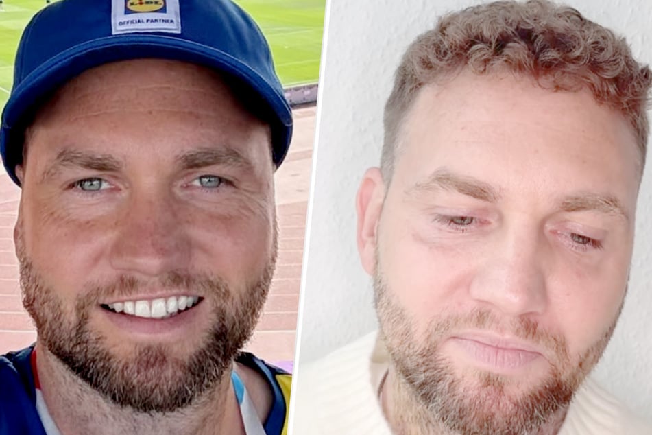 Konstantin "Konsti" Streifling (36) musste sich bereits zweimal einer Operation wegen eines Hirntumors unterziehen.