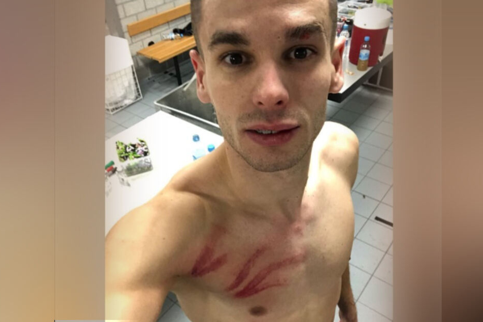 Schwer gezeichnet zeigte sich Eintrachts Mijat Gacinovic nach der Brutalo-Attacke von Schalke-Keeper Alexander Nübel.