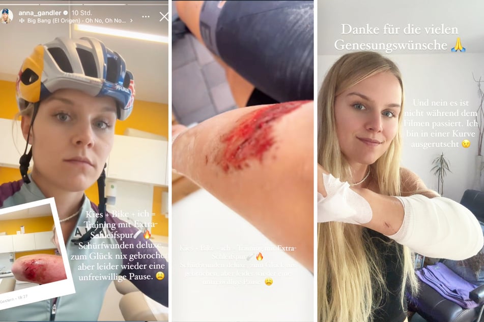 Bei einem Fahrrad-Unfall zog sich Anna Gandler üble Schürfwunden zu.