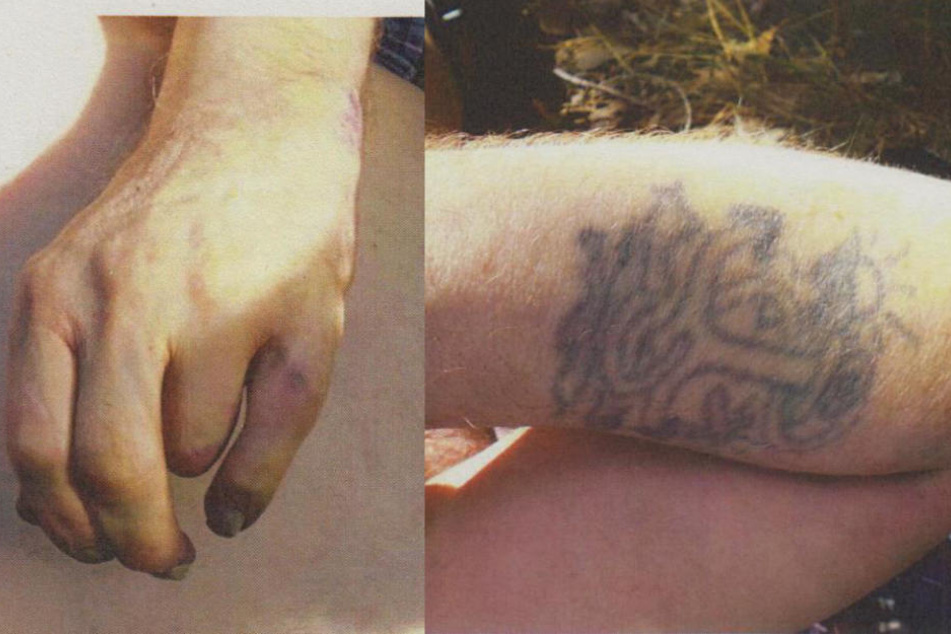 Fehlendes Fingerglied und das Tattoo des unbekannten Toten.