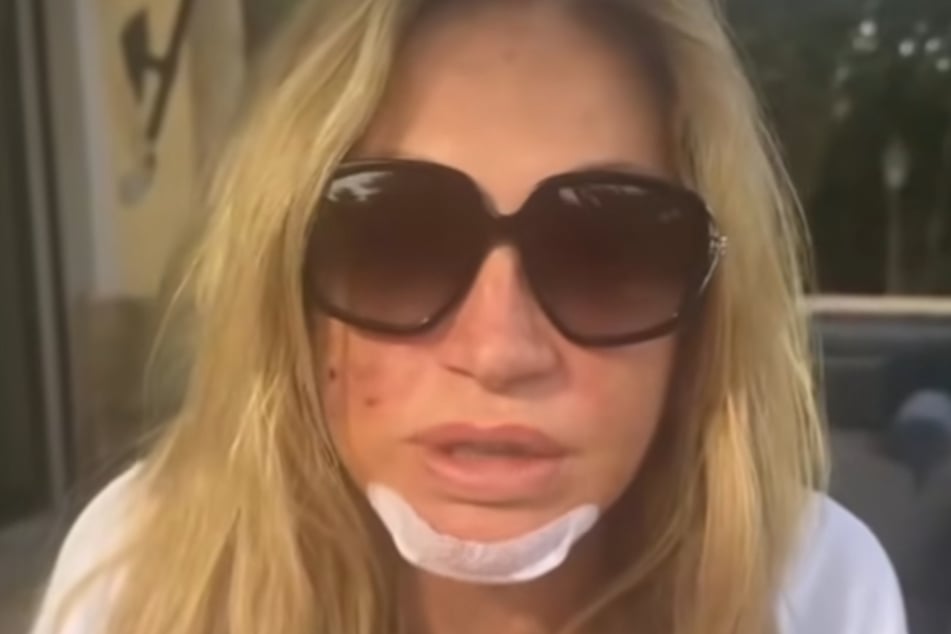 Carmen Geiss zeigte sich nach dem Überfall bei Instagram schwer gezeichnet.