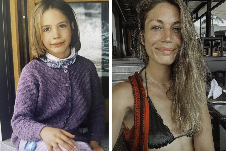 Tessa Bergmeier (32) als kleines Mädchen und als erwachsene Frau. Hat sich ein Beauty-Doc an ihr ausgetobt?