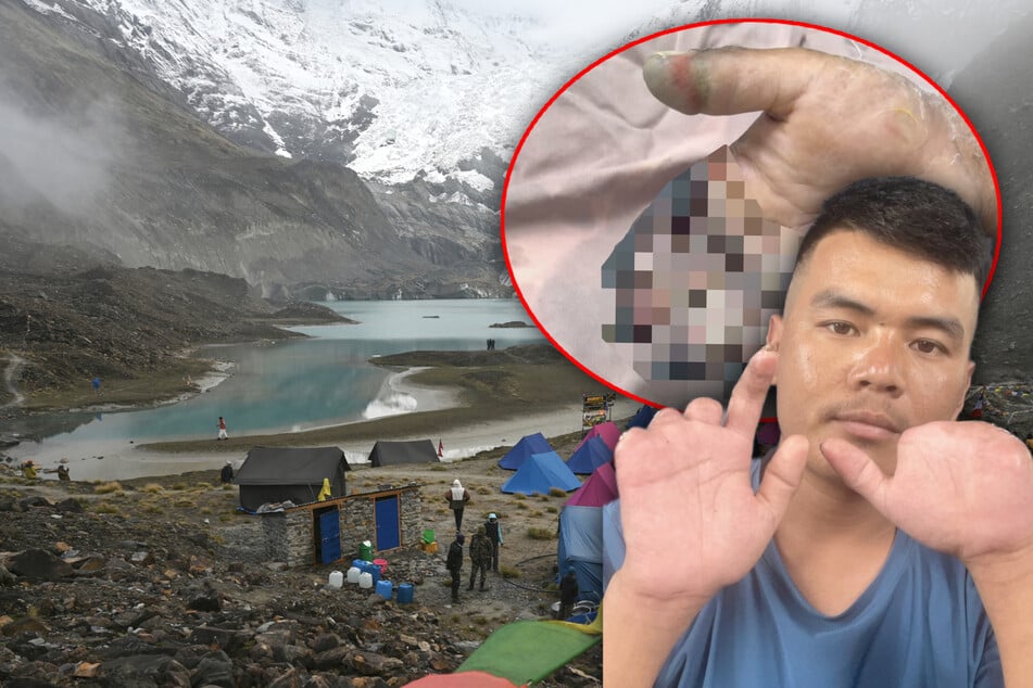 Sherpa verliert nach Überlebenskampf sieben Finger: Ließ ihn sein Kunde auf 7500 Metern zurück?
