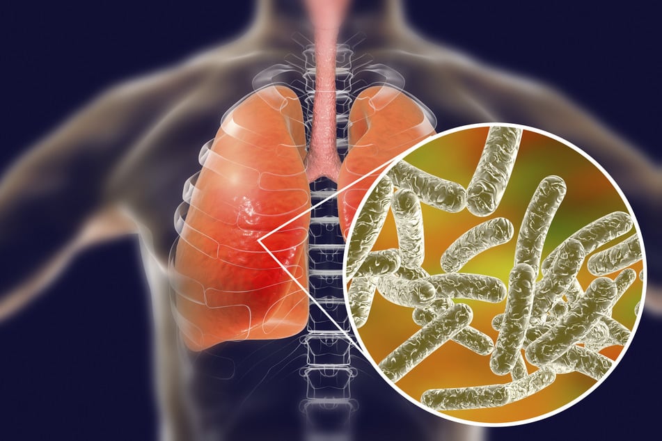 An outbreak of Legionnaires' disease in New York City's Harlem neighborhood is currently under investigation.