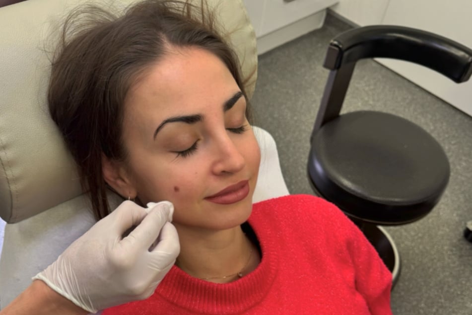 Ekaterina Leonova teilte die letzten Momente vor der Entfernung ihres Muttermals mit ihren Fans.