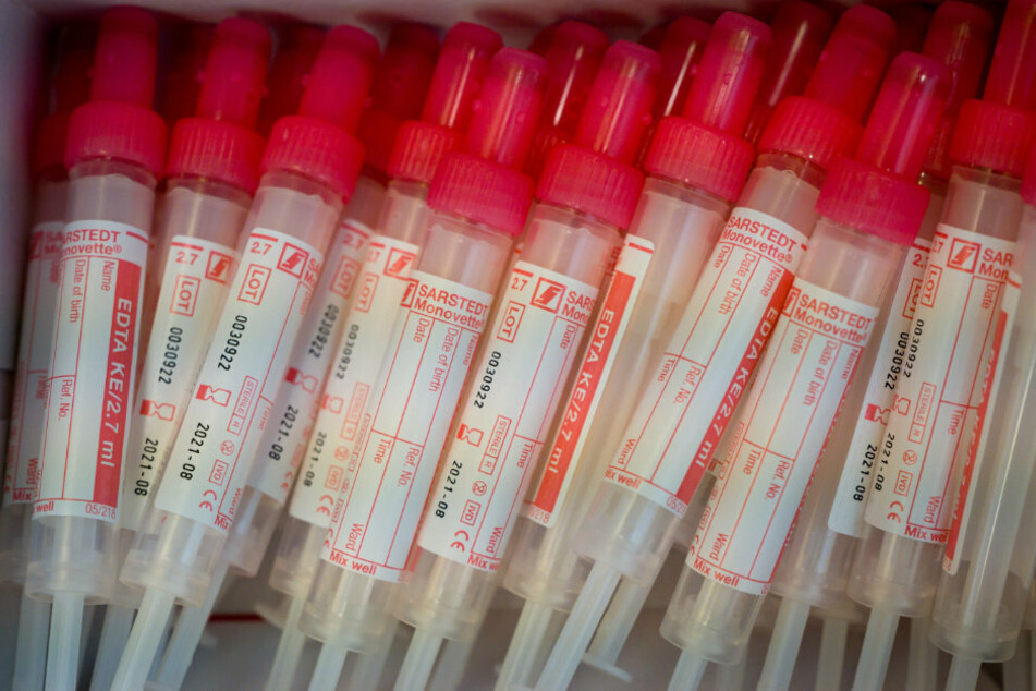 New, empty sample tubes for blood collection in a package.