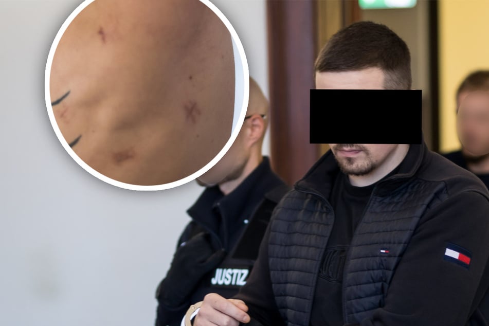 Weil ihn sein Husten störte! Mann (28) will in Leipzig Passanten (42) erstechen