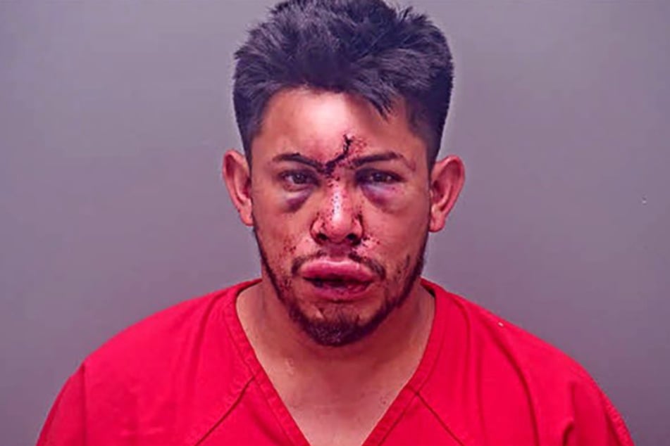 Daniel Hernandez-Lopez (32) byl napaden svým nevlastním synem.