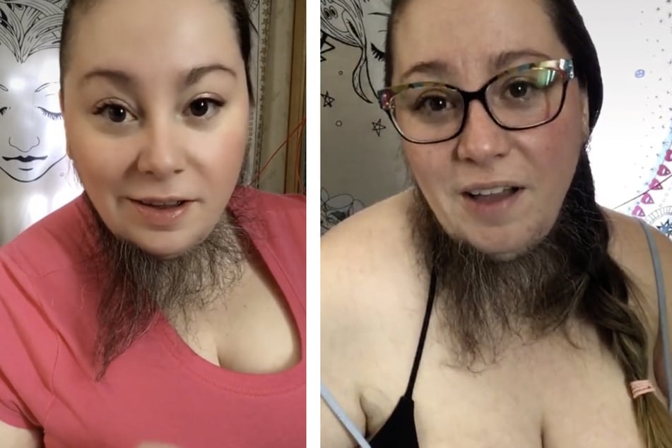 Frau erhält Date-Anfragen, nachdem sie stolz ihren Bart im Netz präsentiert
