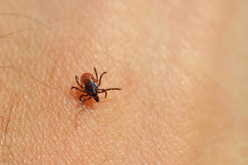 Die Lyme-Borreliose ist die häufigste durch Zecken übertragene bakterielle Infektion.