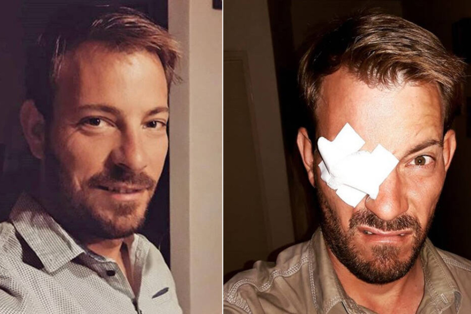 Diesen hübschen Mann entstellt nicht einmal Mull auf den Augen.