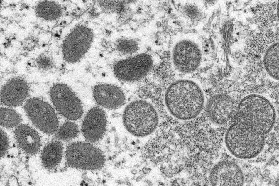 Diese elektronenmikroskopische Aufnahme aus dem Jahr 2003, die von den Centers for Disease Control and Prevention zur Verfügung gestellt wurde, zeigt reife, ovale Affenpockenviren (l.) und kugelförmige unreife Virionen (r.) aus einer menschlichen Hautprobe.