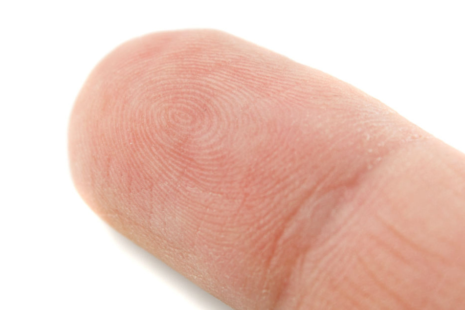 Ob die Fingerkuppe wieder angenäht werden konnte, blieb unklar. (Symbolbild.)