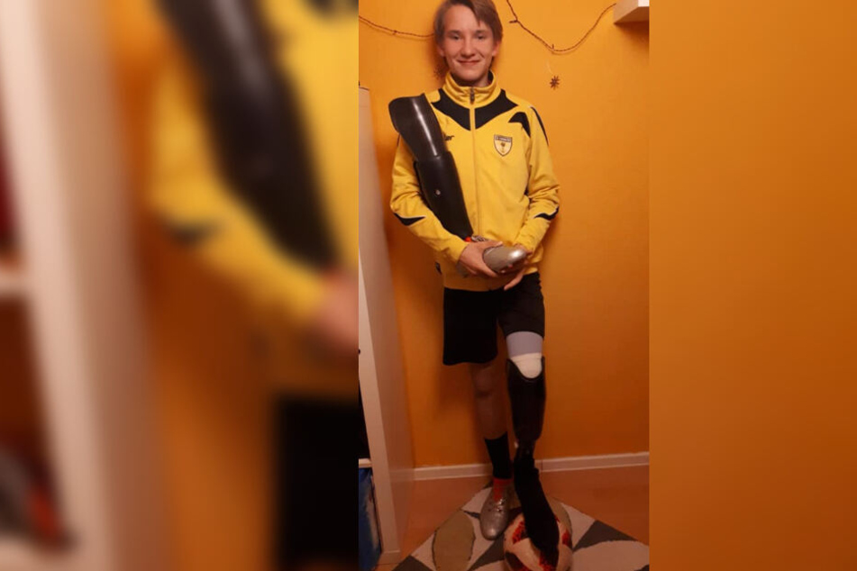 Mit seiner Spezial-Prothese kann Louis nun auch wieder Fußball spielen.