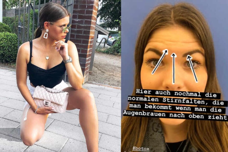 Hamburg: Influencerin nach Botox-Beichte: "Wenn ich böse gucke, sieht das so aus..."