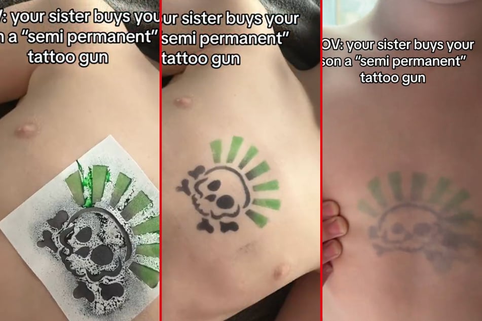 Mom left desperate after son gets "temporary" tattoo that was more permanent than expected