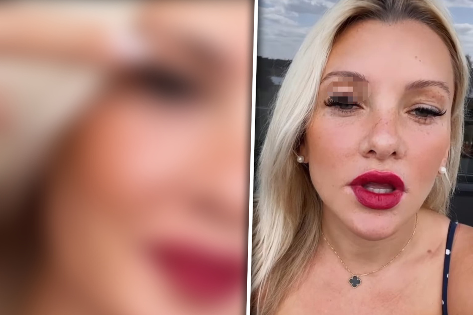 Evelyn Burdecki: Evelyn Burdecki hantiert mit Cellulite-Creme, doch das geht fast ins Auge
