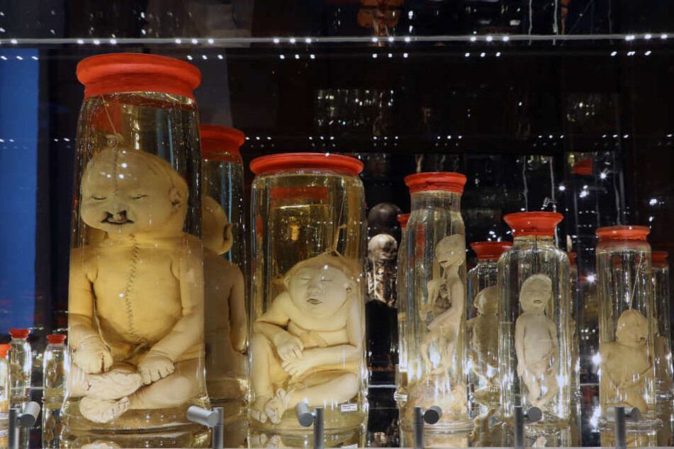 Die Sammlung konservierter menschlicher Föten stammt aus dem Nachlass der Leipziger Apothekerfamilie Link.