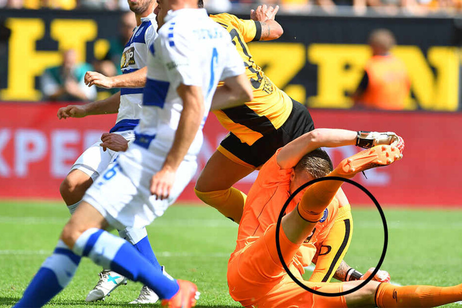 Pascal Testroets Knie verbog sich beim Zusammenprall mit Gäste-Keeper Mark Flekken komplett.