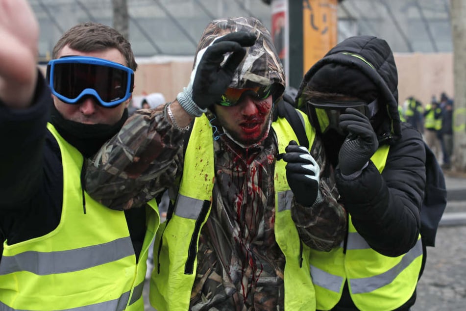 Ein Demonstrant der "Gilets Jaunes" (Gelbwesten) ist mit Blut beschmiert, nachdem er beim Protest verletzt wurde.