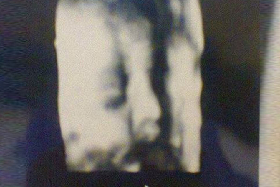 Dieses Ultraschallbild erhielten gleich mehrere werdende Mütter.