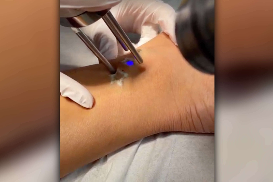 Amira Pocher (29) gab ihren Instagram-Fans einen kleinen Einblick in die Behandlung.