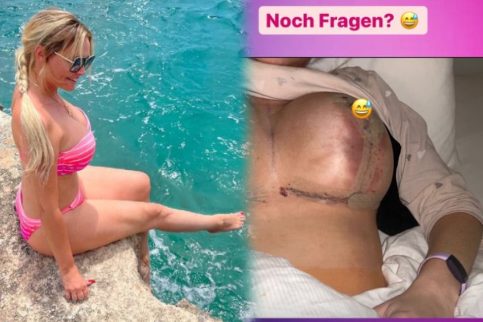 Daniela Katzenberger: Daniela Katzenberger offenherzig: So zufrieden ist sie mit ihren neuen Brüsten