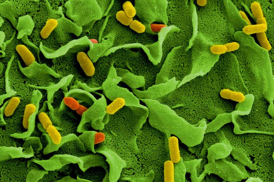 Elektronenmikroskopische Aufnahmen von Listerien (Listeria monocytogenes) auf der Oberfläche einer dendritischen Zelle.