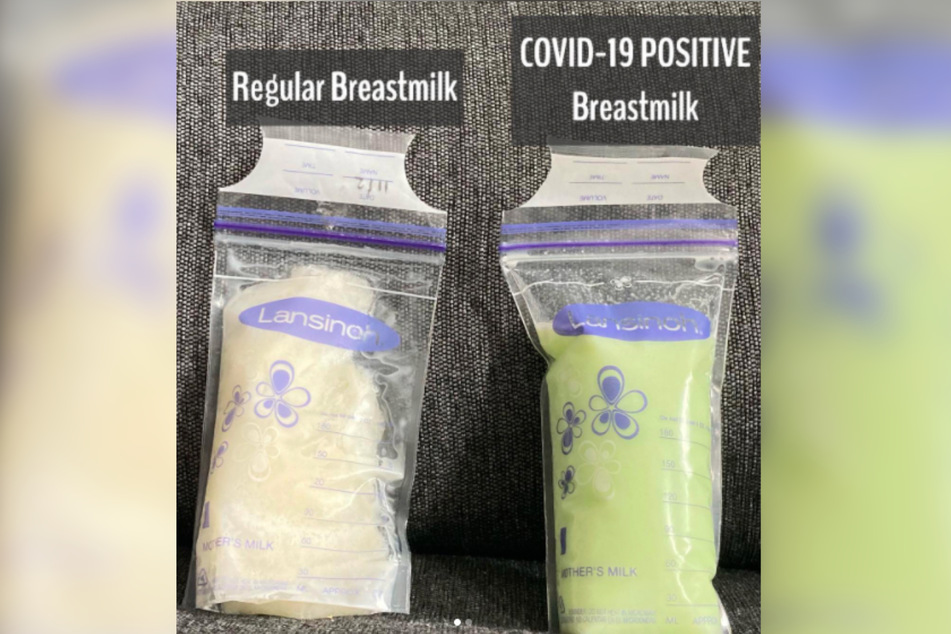 Links sieht man, wie Ashmirys Muttermilch normalerweise aussieht. Während ihrer Corona-Infektion färbte sich die Milch grün.