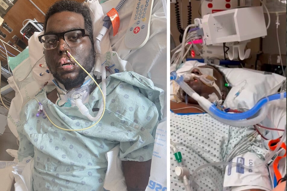Davon Vanterpool (34) wurde nach einem Zahnarztbesuch mit einer Sepsis ins Krankenhaus eingeliefert. Dort wurden ihm die Gliedmaßen teilweise komplett amputiert.