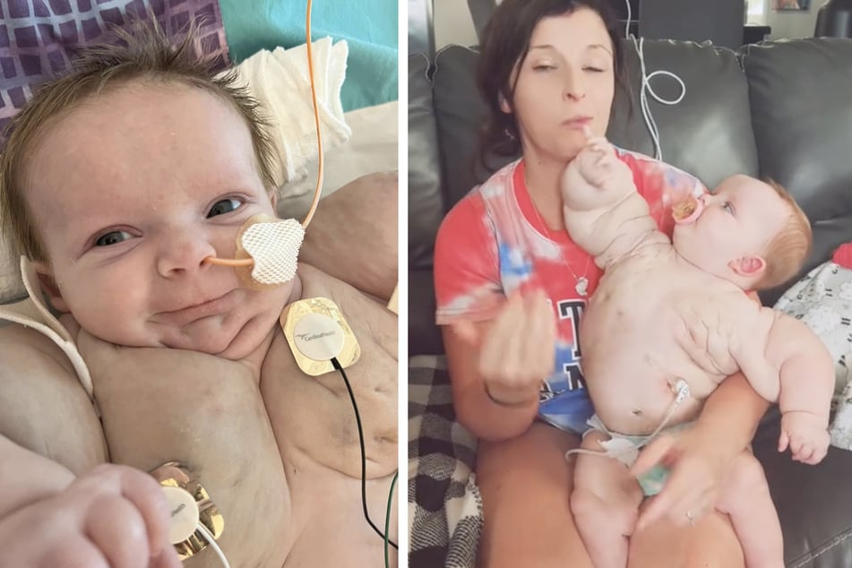 Chelsey Milby (33) brachte vor neun Monaten die kleine Armani zur Welt, die unter einer seltenen Erkrankung leidet.